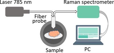 Differentiation of glioblastoma tissues using spontaneous Raman scattering with dimensionality reduction and data classification